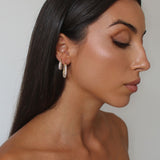 Amber Medium Hoops